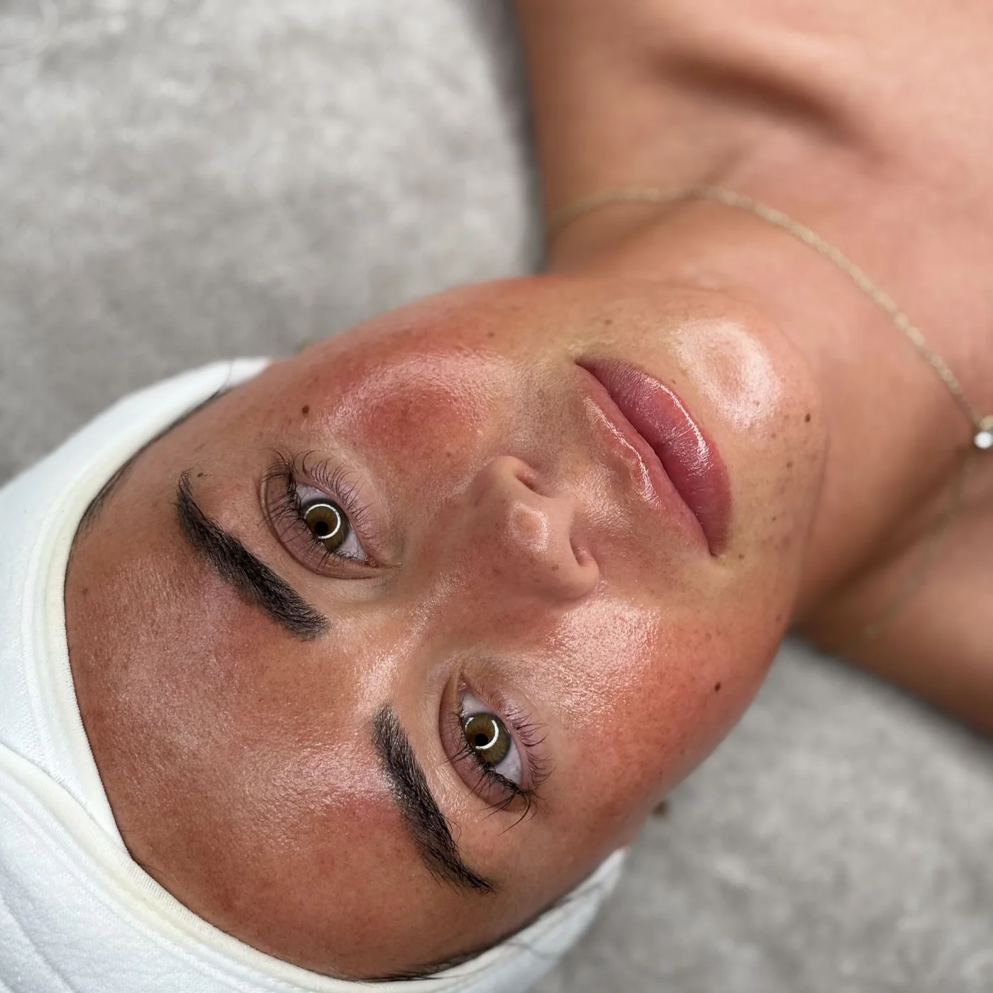 A client’s skin following a customised facial