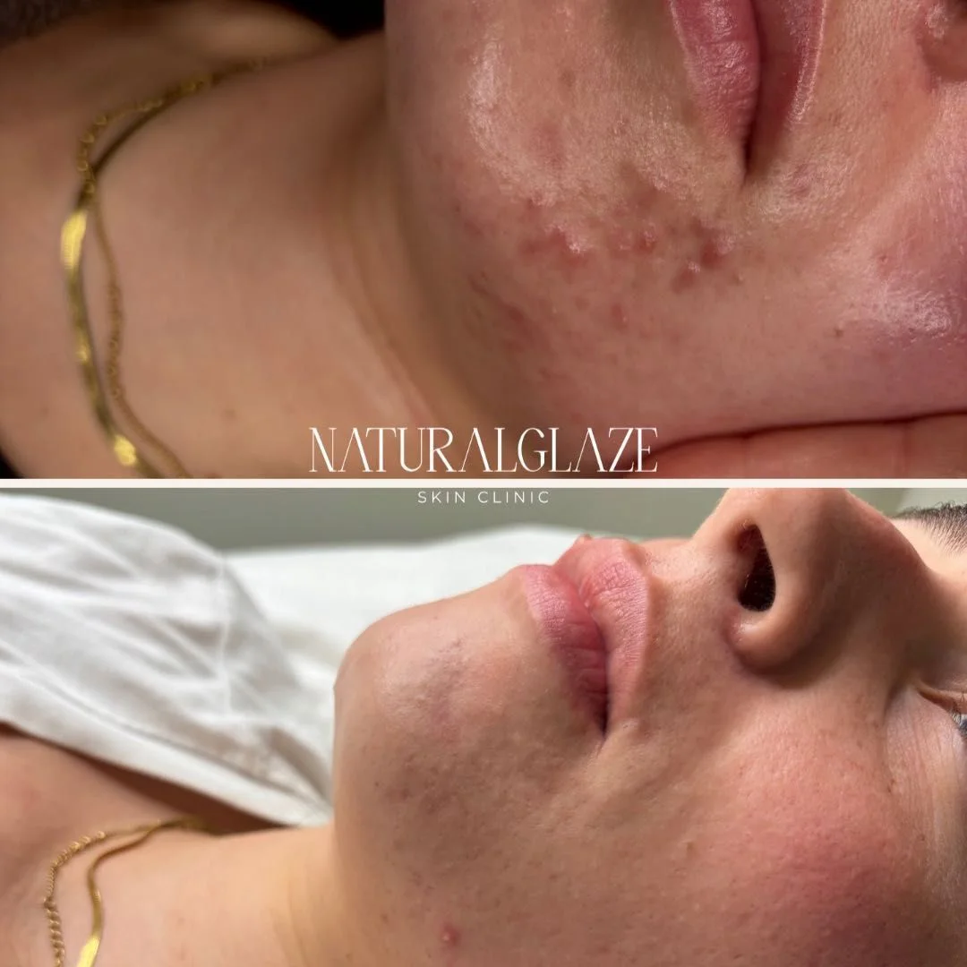 A client skin comparison shared by the clinic
