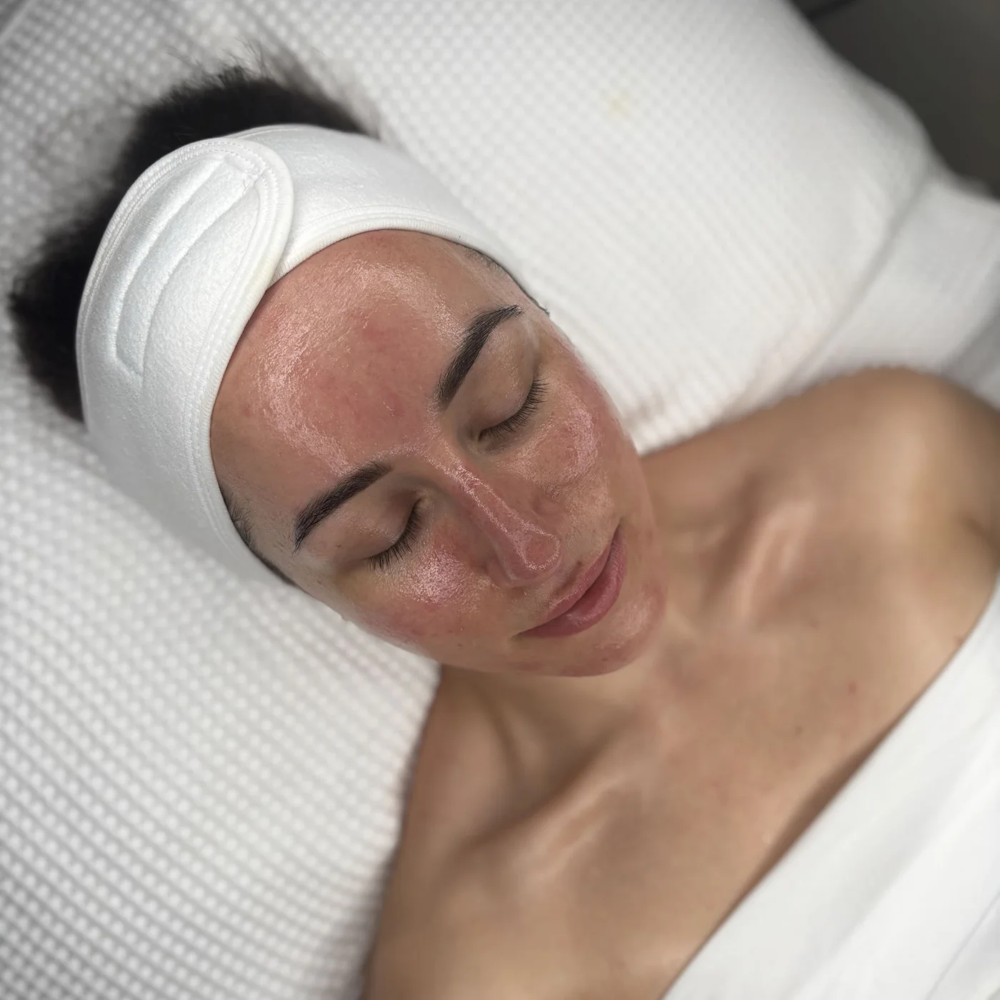 A client relaxing after a facial at the clinic